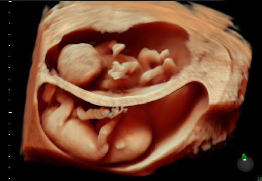 Twins Well-being + HD Live