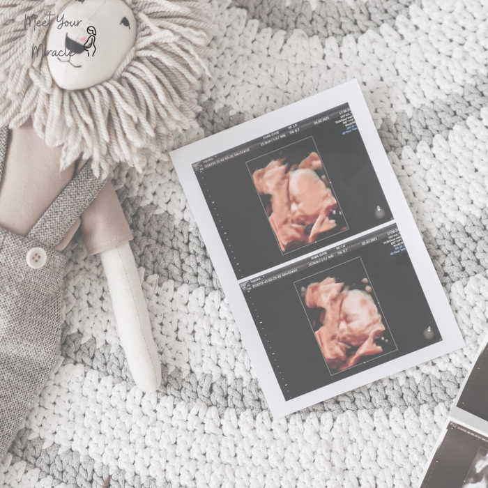 Well-being +HD Live Scan (5D)