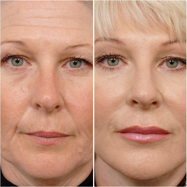 schedule-appointment-with-glameria