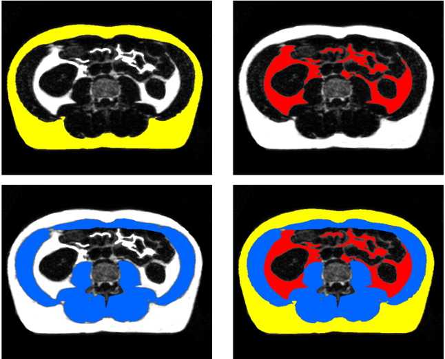 Schedule Appointment with First Look MRI Alliance