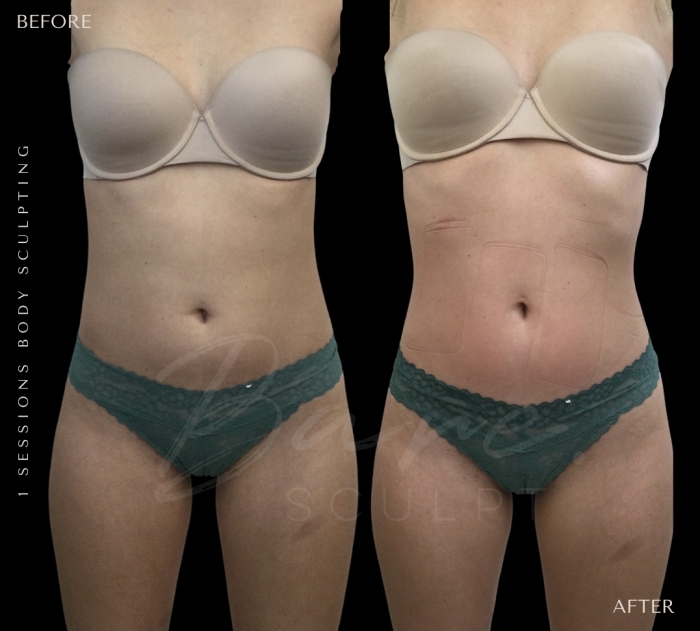 Schedule Appointment With Baresculpt