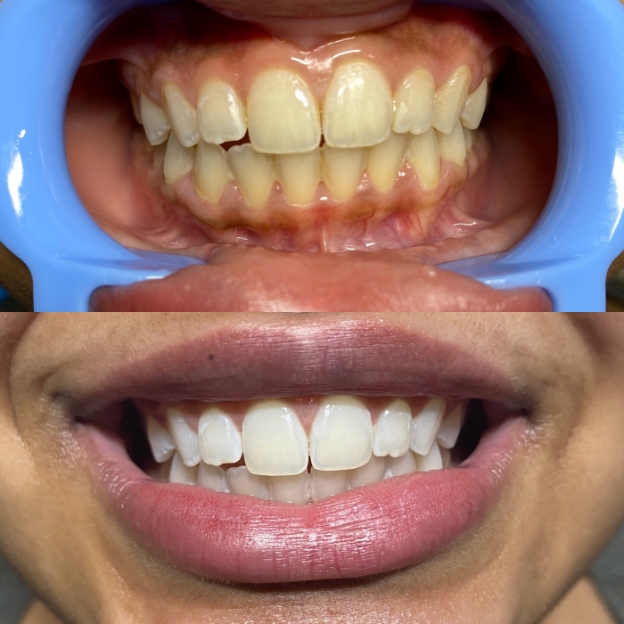 Schedule Appointment with Beach Pearls Whitening Spa