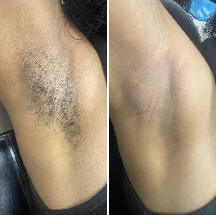 Schedule Appointment with KOI Aesthetics