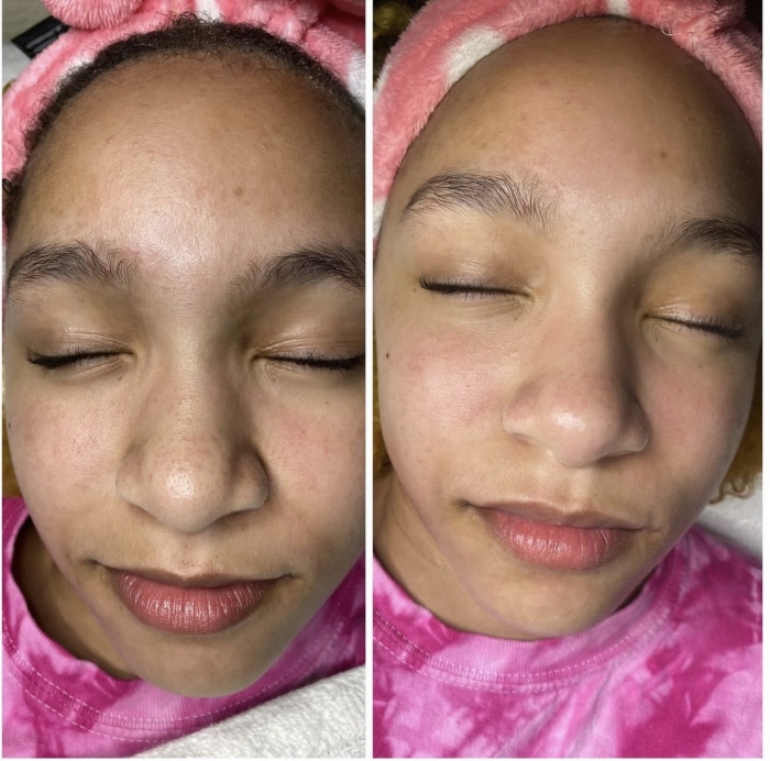 Schedule Appointment with KOI Aesthetics